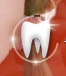 ILLUSION DENTAL LABORATORY